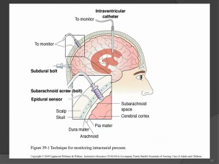 neurologic disorders part1